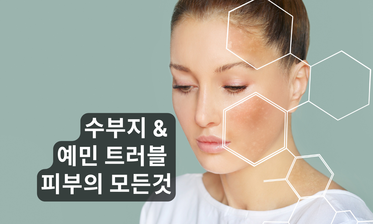 [3/11,수][제휴세미나/광주광역시] 수부지 & 예민 트러블 피부의 모든것