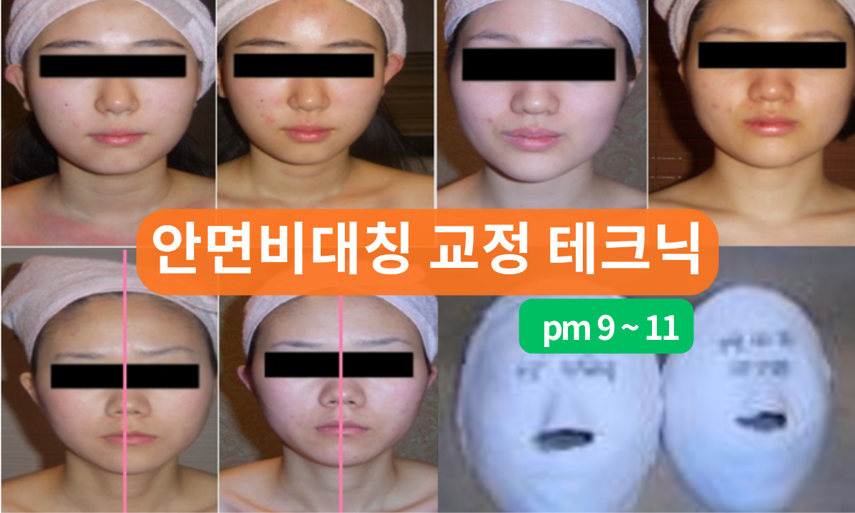 [8/19,수][줌교육/9~11PM] 안면비대칭 교정 테크닉