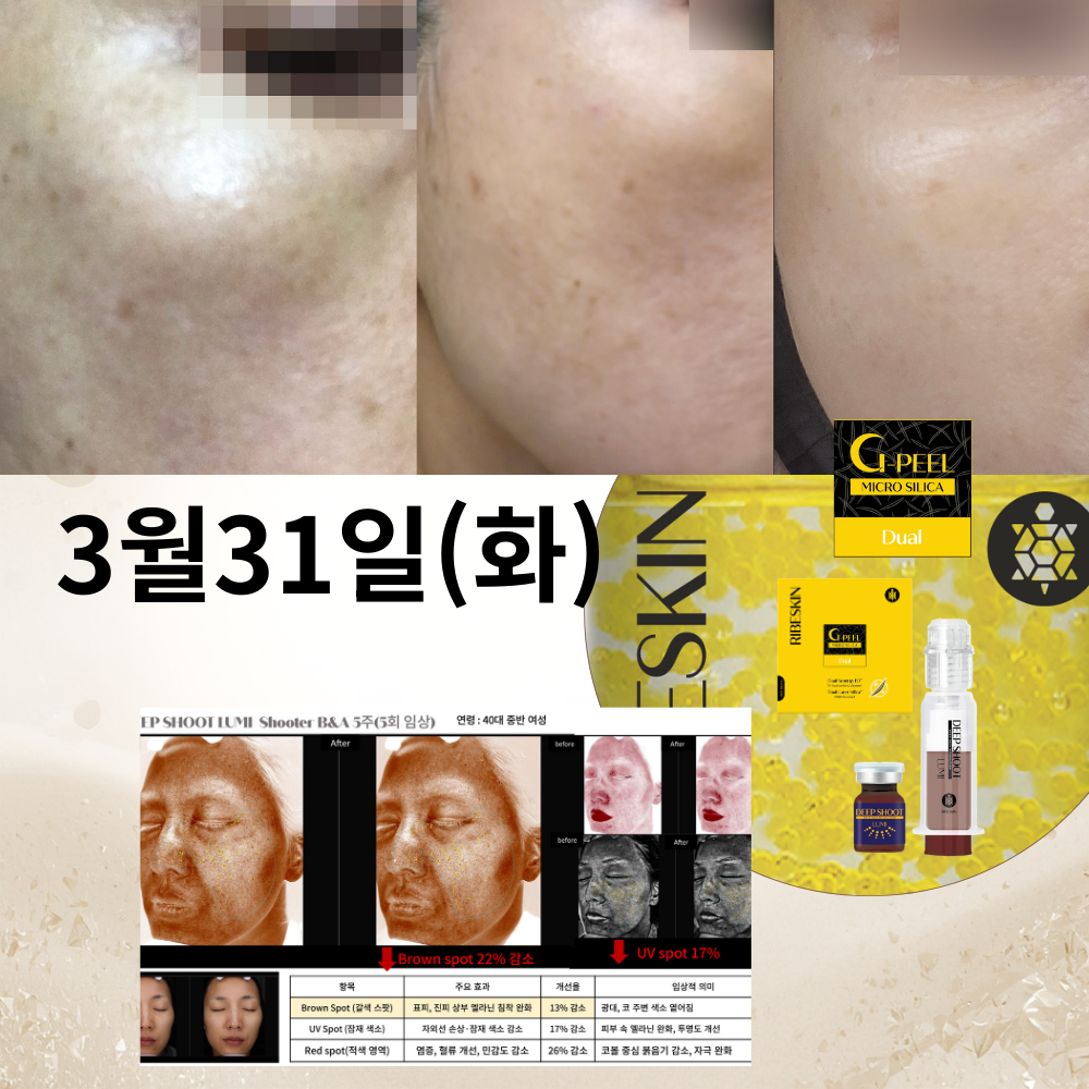 KakaoTalk_20260312_155716688.png
