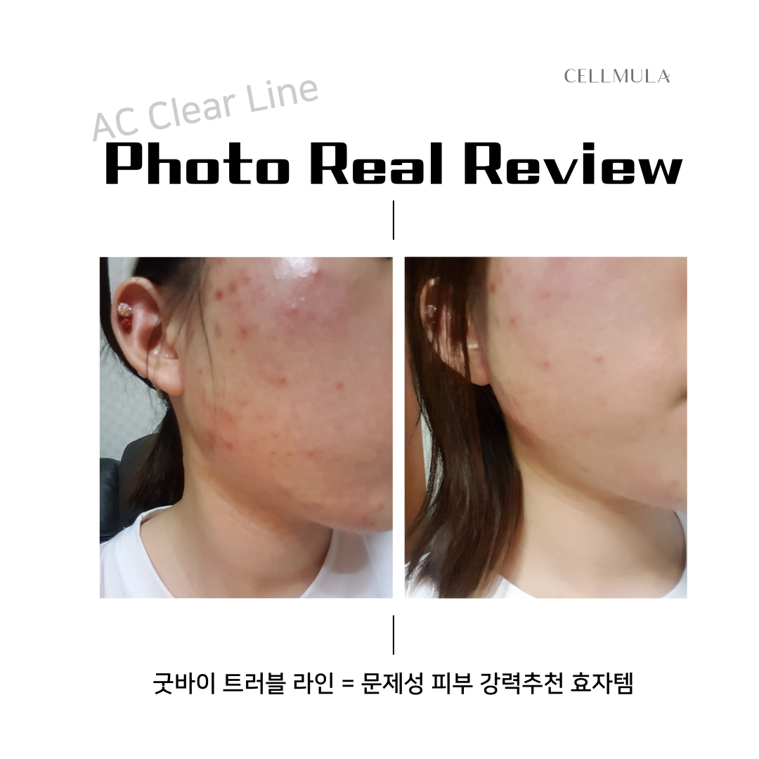 BTI에듀넷) AC라인-Photo Real Review.png